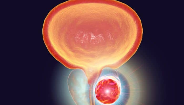 The Relationship of zinc to the prostate