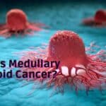 Medullary Thyroid Cancer: Symptoms, Diagnosis, and Treatment - A Comprehensive Guide