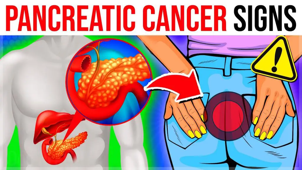 Top 8 Symptoms Of Pancreatic Cancer That Will Shock You
