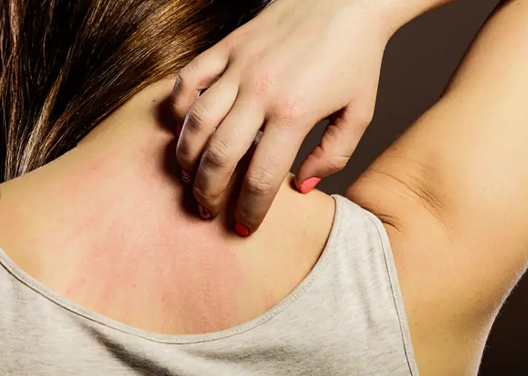 "Graphic of bruised skin and bleeding caused by liver failure, urging early diagnosis and emergency coverage through critical illness insurance."
