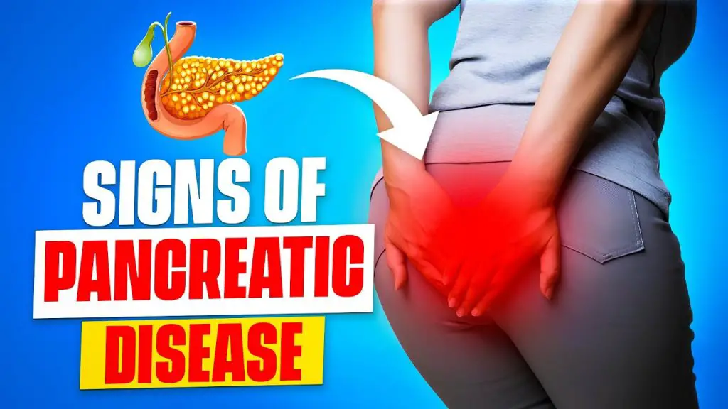 10 Early Warning Signs of Pancreatic Cancer You Need to Know